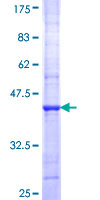 12.5% SDS-PAGE Stained with Coomassie Blue.